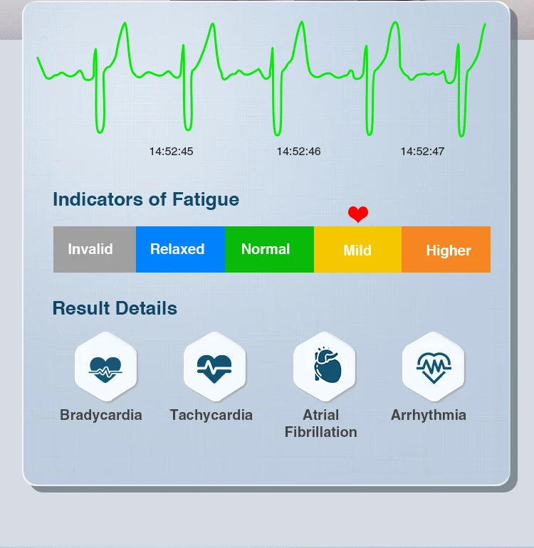 Portable Mobile Electrocardiograph, 24 Hour Wearable Wireless Cardiac EKG Monitor, Personal Heart Rate & ECG Recorder Machine